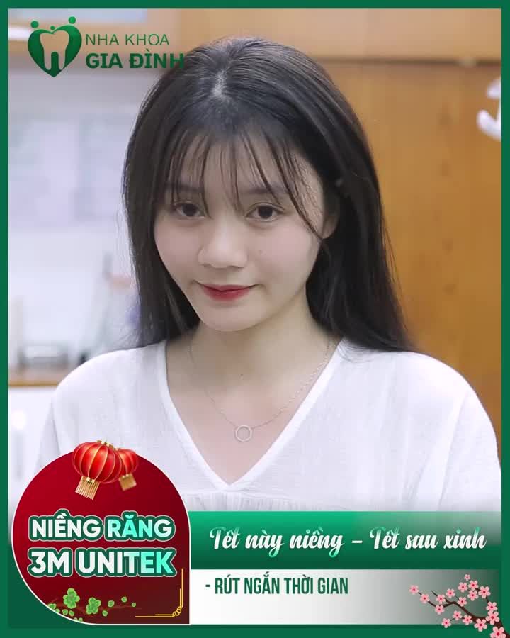RÚT NGẮN THỜI GIAN ĐEO NIỀNG KHI CHỈNH NHA TẠI NHA KHOA GIA ĐÌNH