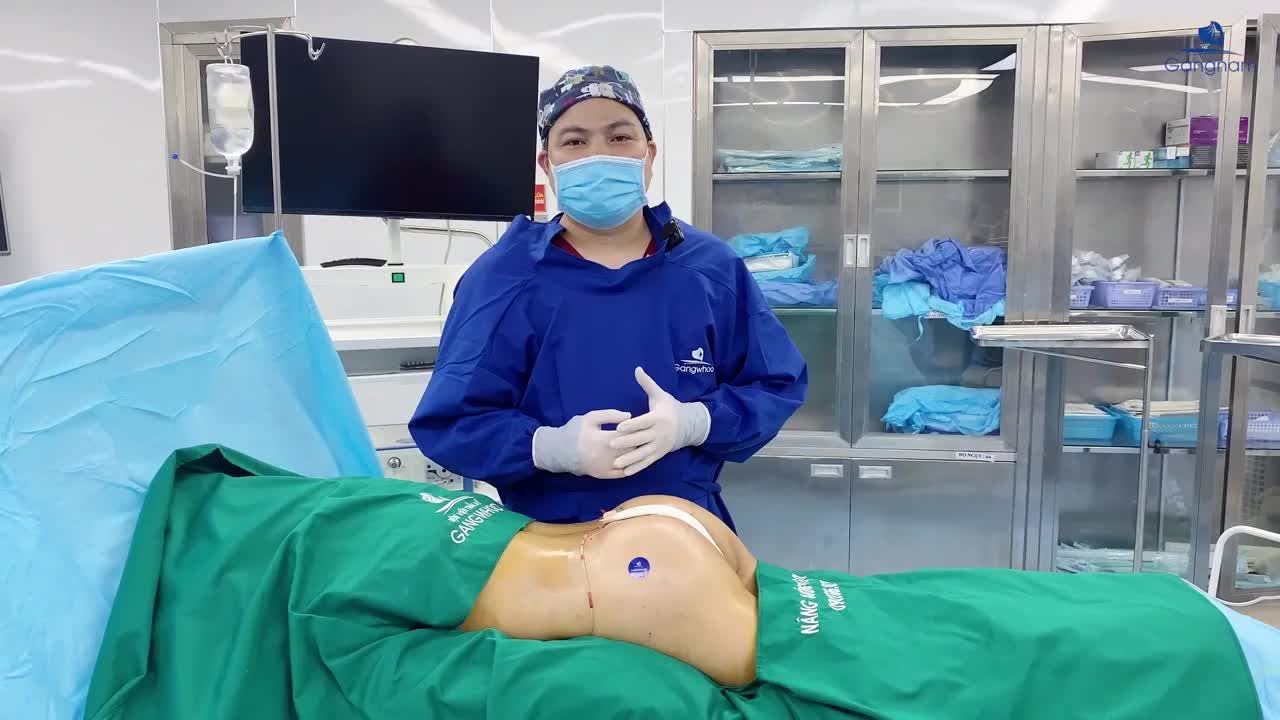 ĐỘN MÔNG KIÊNG QUAN HỆ TRONG BAO LÂU?