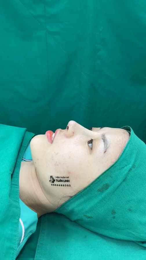 Thay dáng mũi - Đổi nét sang đón năm mới rạng ngời.