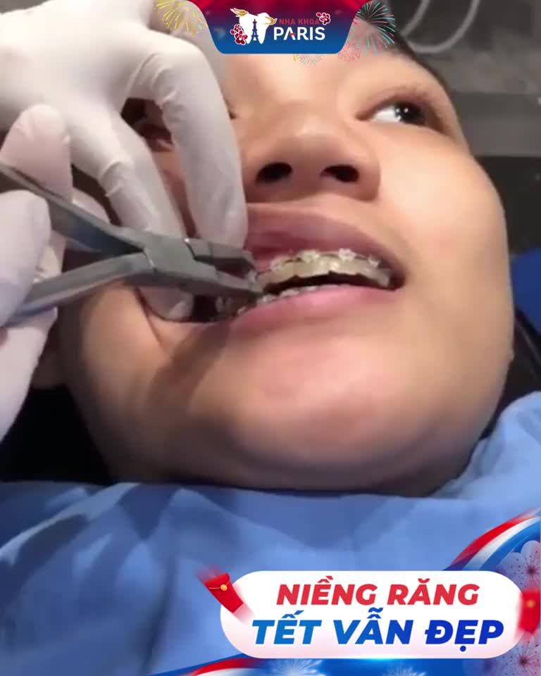 Giây phút hạnh phúc của các bạn niềng răng là đây