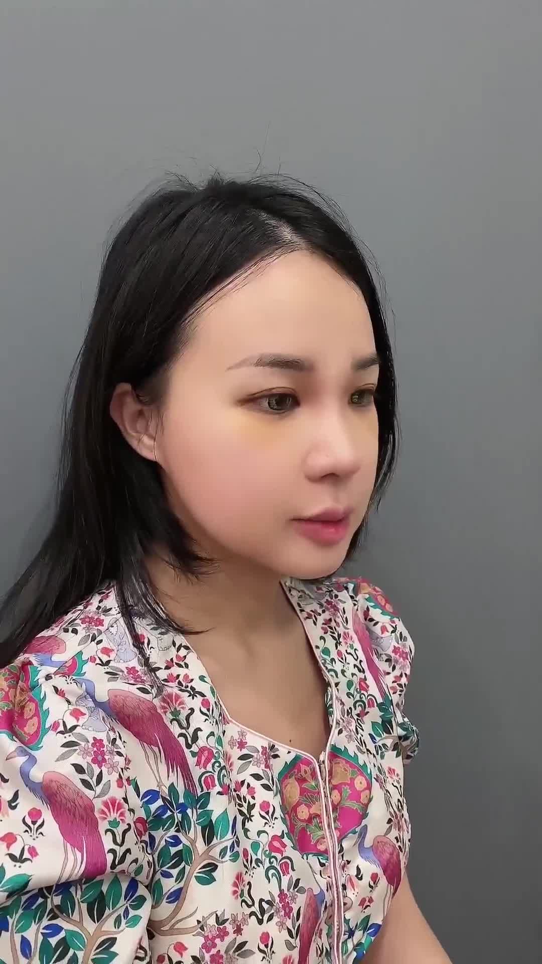 Khách hàng bất ngờ với nhan sắc mới cùng dáng mũi sau 5 ngày