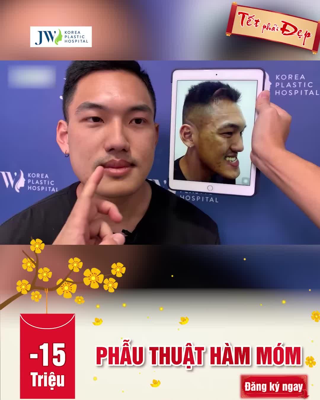CHÀNG VIỆT KIỀU HÓA SOÁI CA CHỈ VỚI PHẪU THUẬT HÀM MÓM