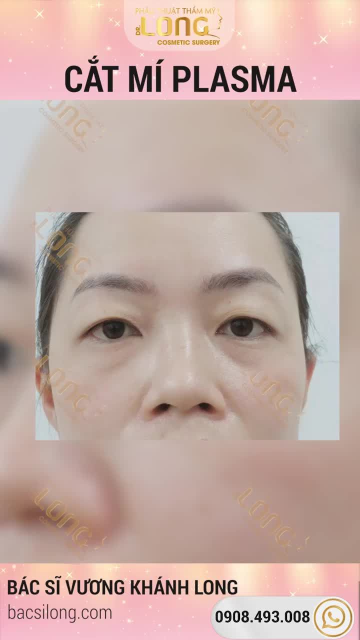 RỒI DẠO NÀY KHÁCH HAY HỎI “CẮT MÍ XONG” CÓ KHÁC BIỆT NHIỀU KHÔNG?