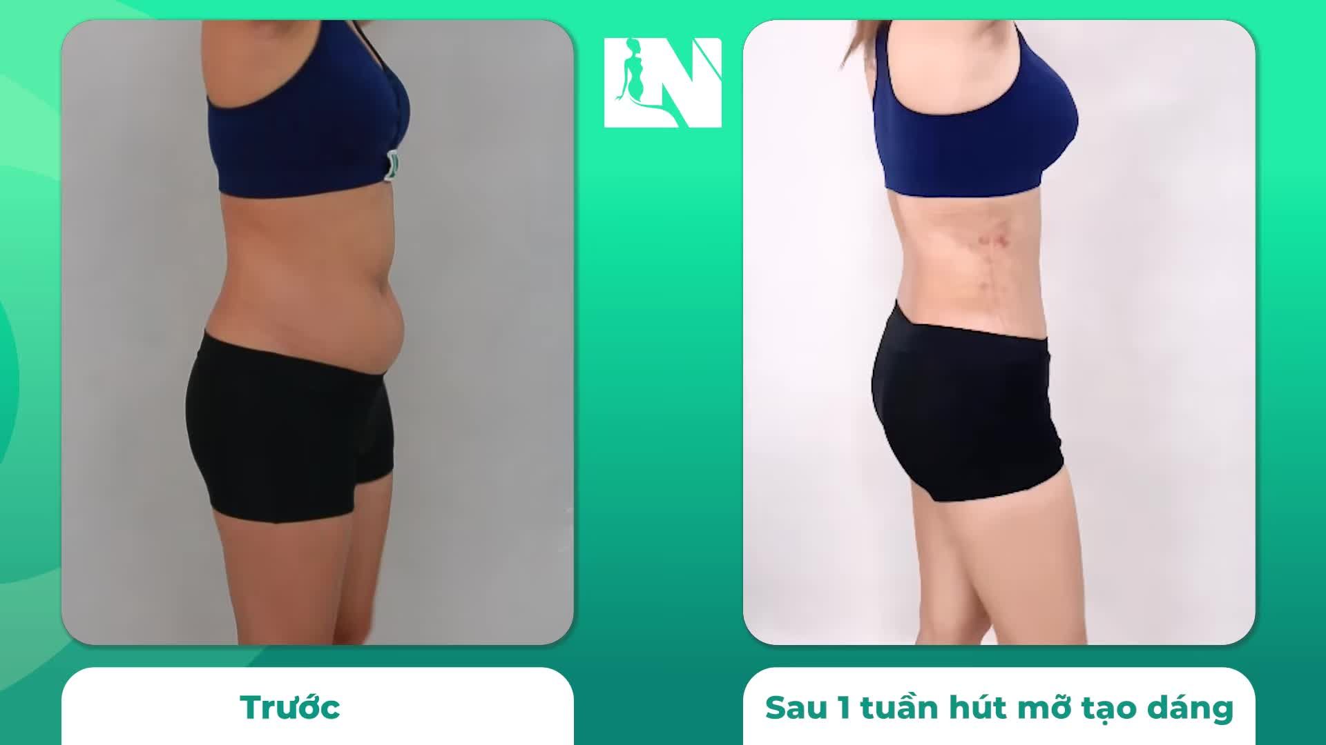 Chị đã lựa chọn, được sống trọn khoảnh khắc đẹp nhất thời Thanh Xuân!