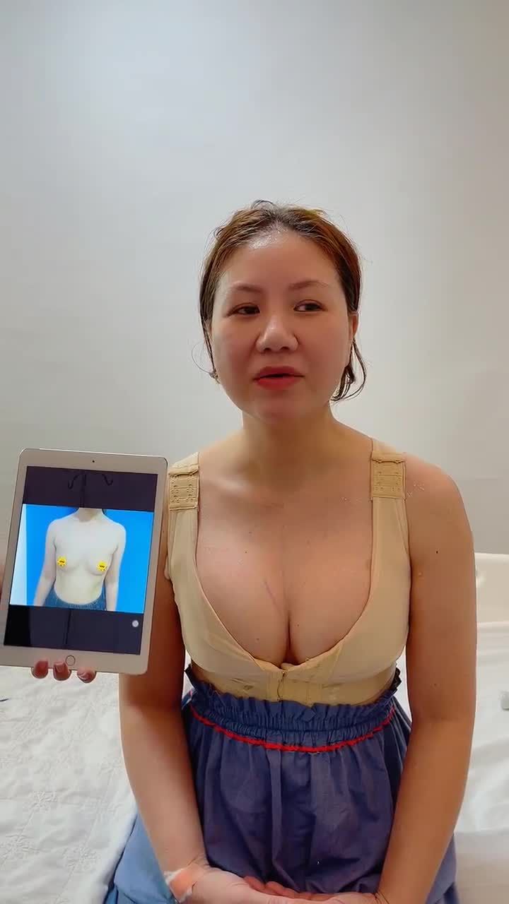 Hạnh phúc VỠ ÒA sau khi nâng ngực - Khách hàng chia sẻ cảm nghĩ ngay tại phòng hậu phẫu thuật!