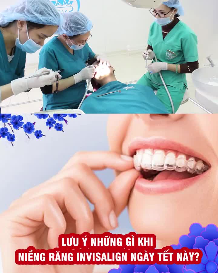 Lưu ý khi niềng Invisalign ngày Tết?