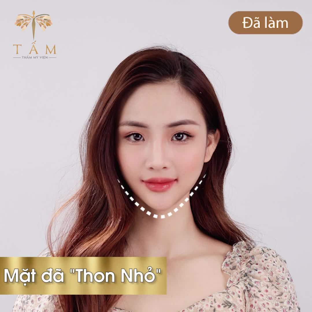 BIẾN MẶT "ULINE" MẶT "VLINE" 45 PHÚT TIN ĐƯỢC KHÔNG???