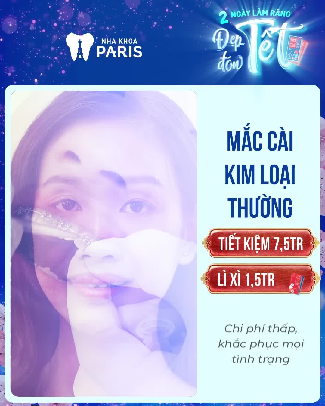 NIỀNG RĂNG SIÊU SALE XUÂN QUÝ MÃO
