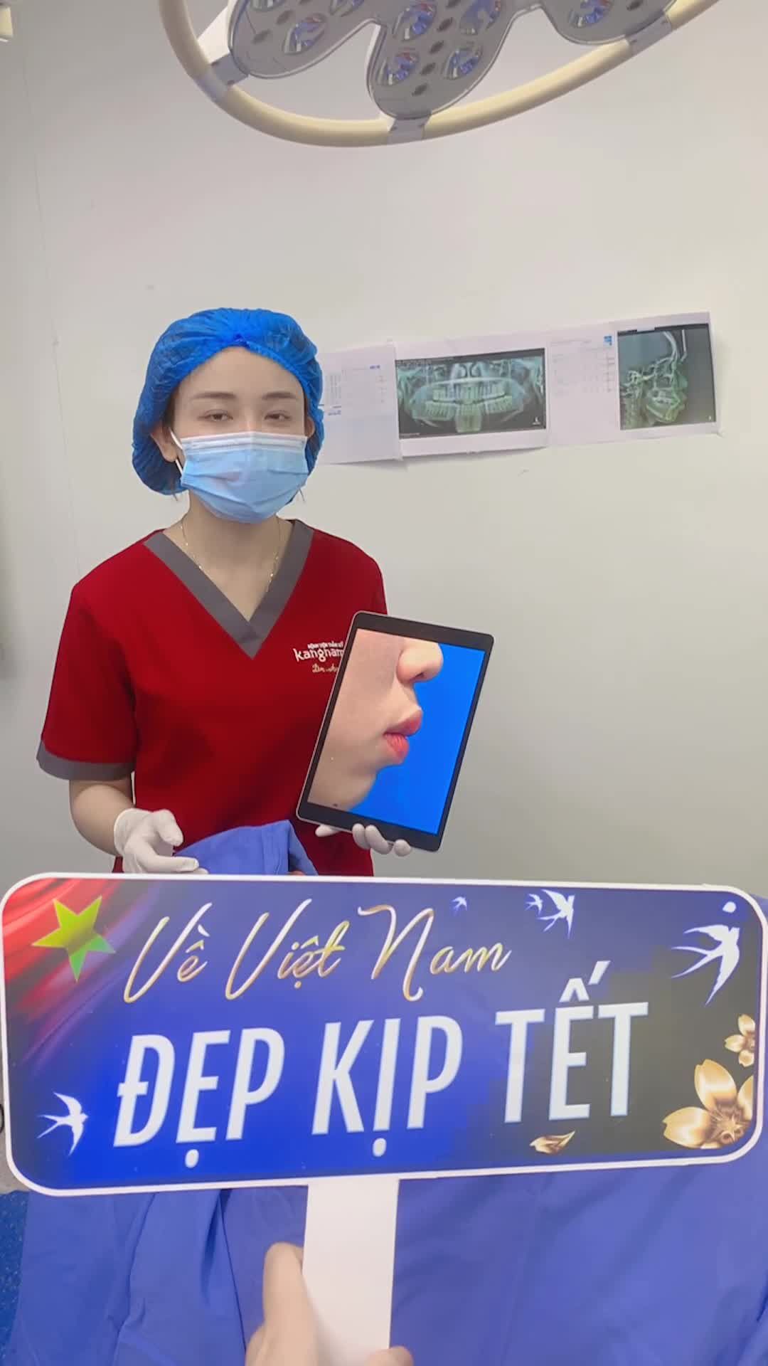 Kết quả Phẫu thuật 2 hàm thực hiện tại Kangnam Hà Nội