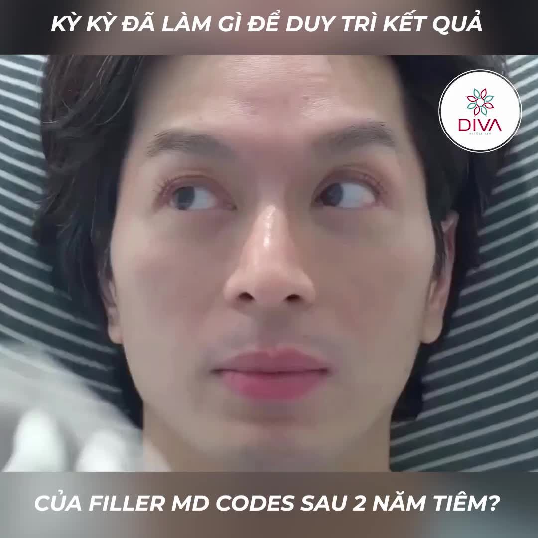 BÍ MẬT ĐẰNG SAU VẺ ĐẸP KHÔNG TUỔI CỦA HOT YOUTUBE KỲ KỲ LÀ GÌ?