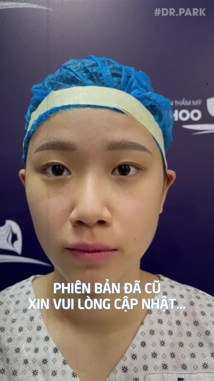 NHẤN MÍ (BẤM MÍ) HÀN QUỐC - 30 PHÚT MÍ BIẾN ĐÔI MẮT HÚT HỒN