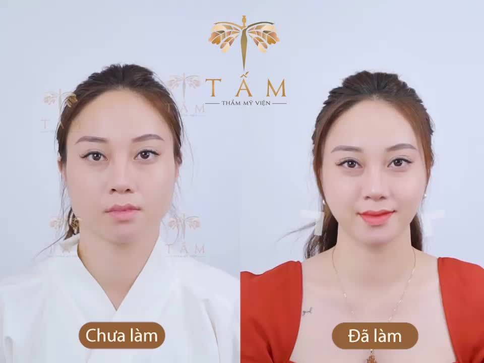 BÍ KÍP ĐỂ SELFIE KHÔNG CẦN APPS BÓP MẶT LÀ ĐÂY