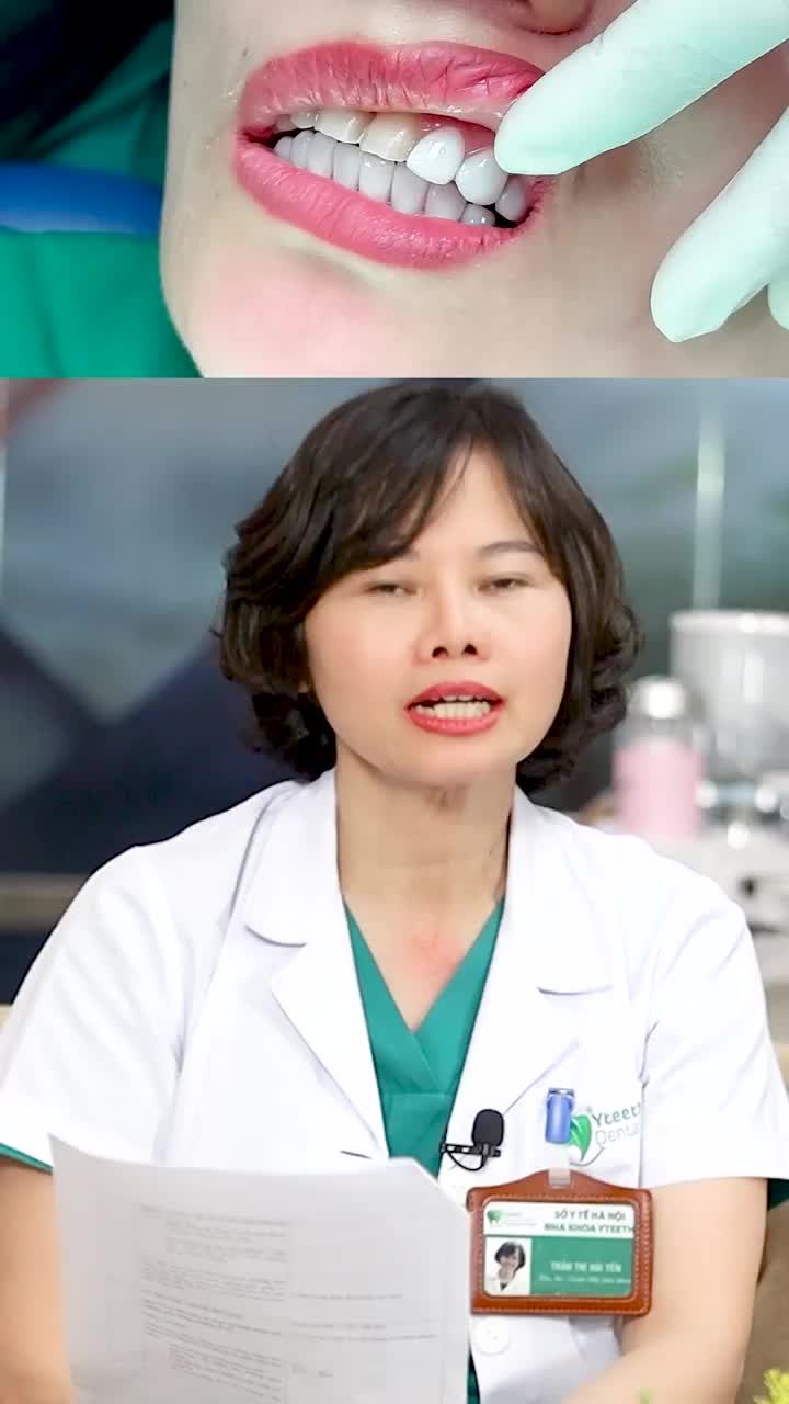 Răng sứ có dễ bị ố vàng không?