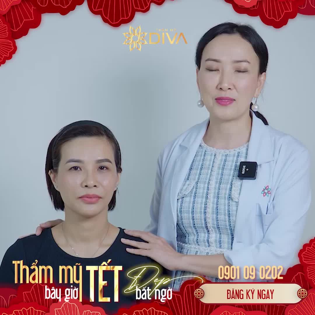 LÀM ĐẸP KỊP TẾT: TIÊM FILLER MD CODES CẢI THIỆN THẦN THÁI NHANH, KHÔNG VẾT TÍCH, KHÔNG SƯNG BẦM CÓ KẾT QUẢ NGAY SAU THỰC HIỆN