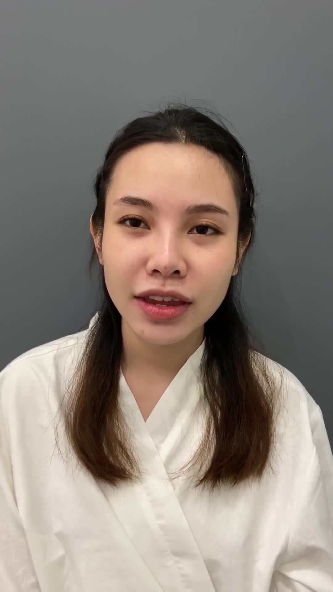 CHIA SẺ CỦA CHỊ KHÁCH HÀNG BỊ LỘ SỤN, VIÊM ĐẦU MŨI CÁCH ĐÂY 3 NĂM