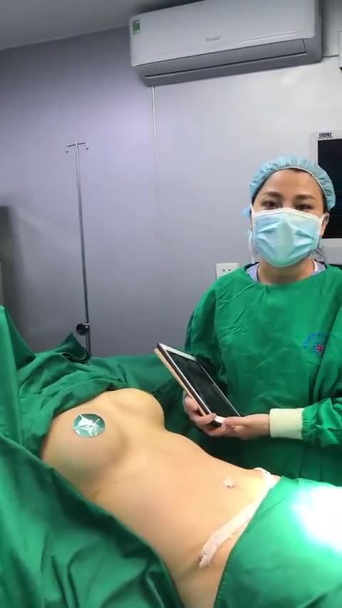 Ca Hút mỡ tạo hình thành bụng chuyển rốn vừa được thực hiện bởi ekip Dr. Minh Phạm