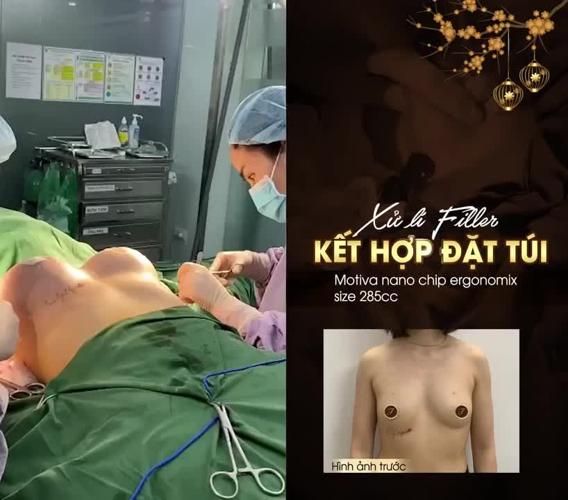 Nâng cấp V1, đón mừng xuân mới