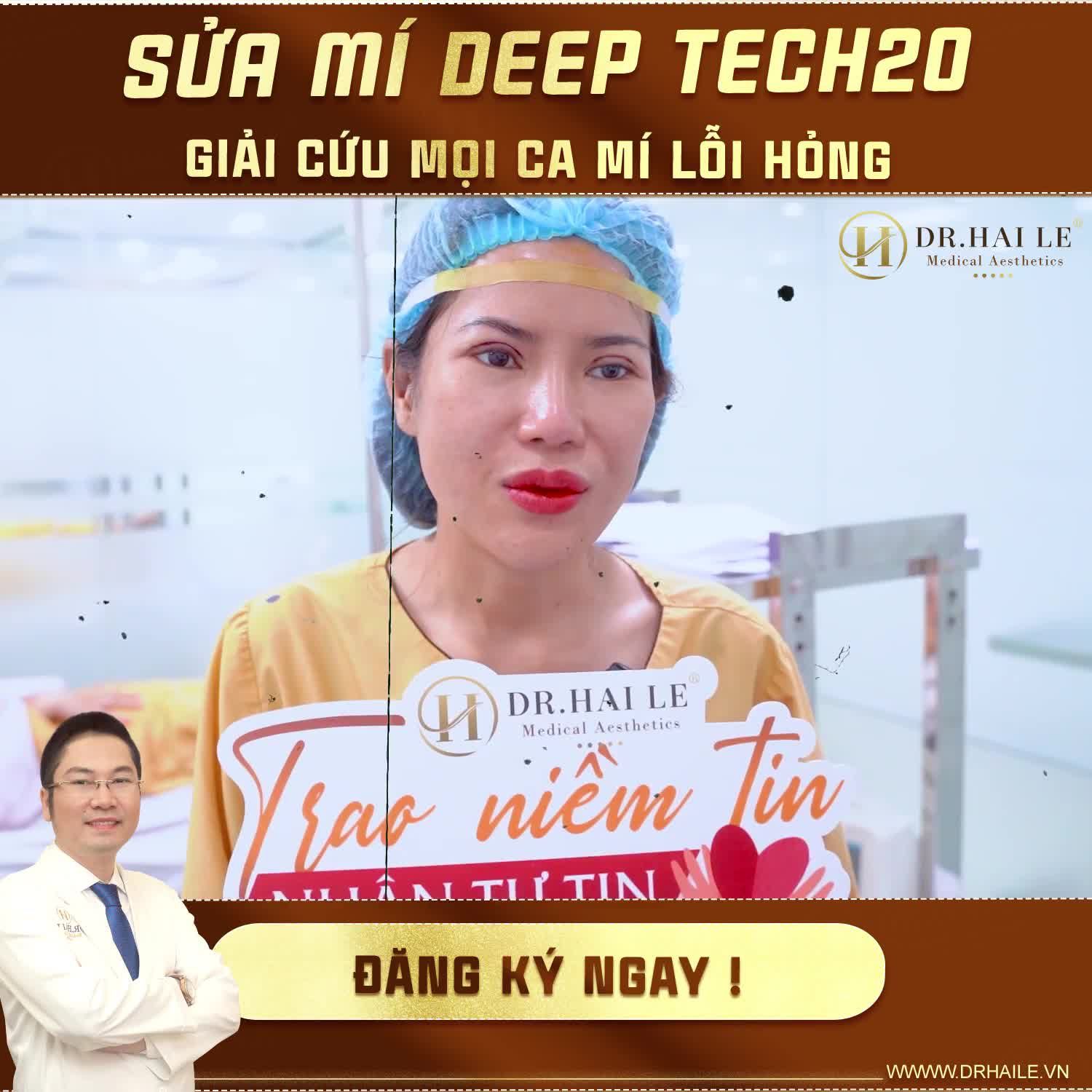 “Cứ có thời gian rảnh là chị lại suy nghĩ” –  Chia sẻ của vị khách hàng cho thấy sự tự ti, stress của chị khi mí bị lỗi, hỏng
