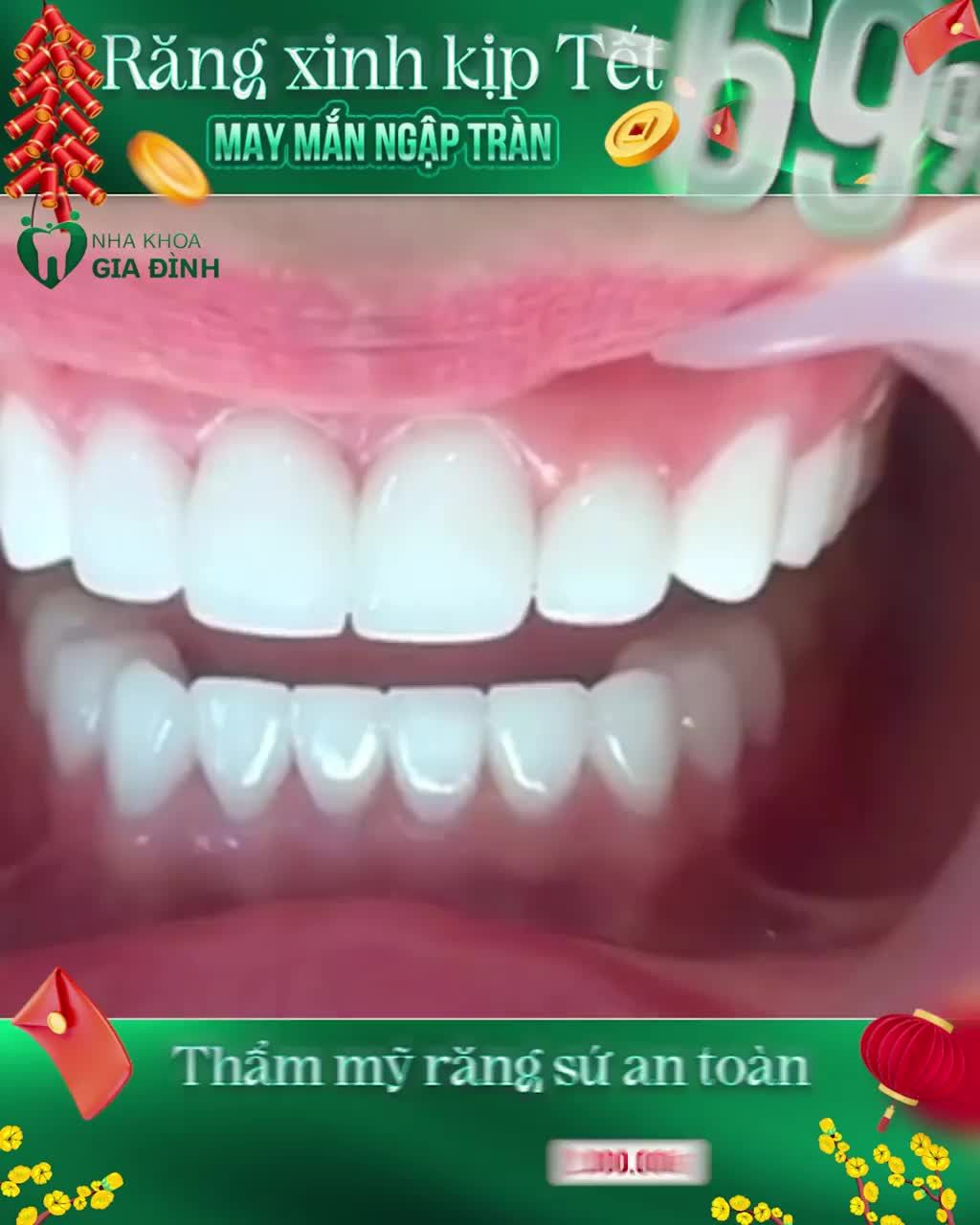 XUÂN QUÝ MÃO - CHIẾM TRỌN CẢM TÌNH VỚI NGƯỜI ĐỐI DIỆN NHỜ NỤ CƯỜI TỎA NẮNG