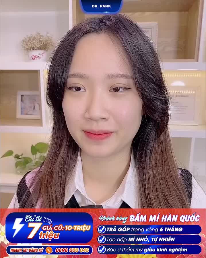 BẤM MÍ HÀN QUỐC - BAO NHIÊU TUỔI THÌ NÊN BẤM MÍ?