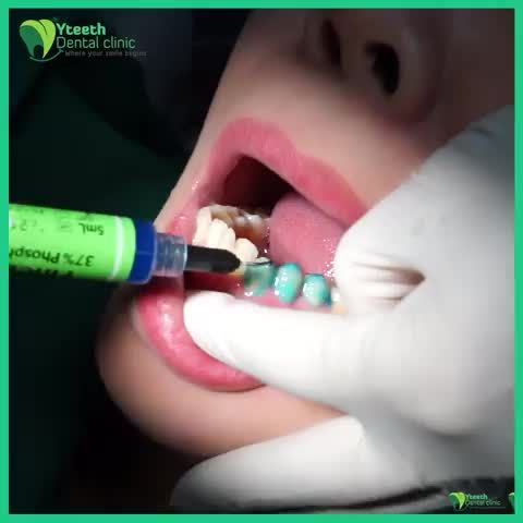 Làm răng xinh đón Tết cùng bác sĩ Hải Yến tại Nha khoa Yteeth!