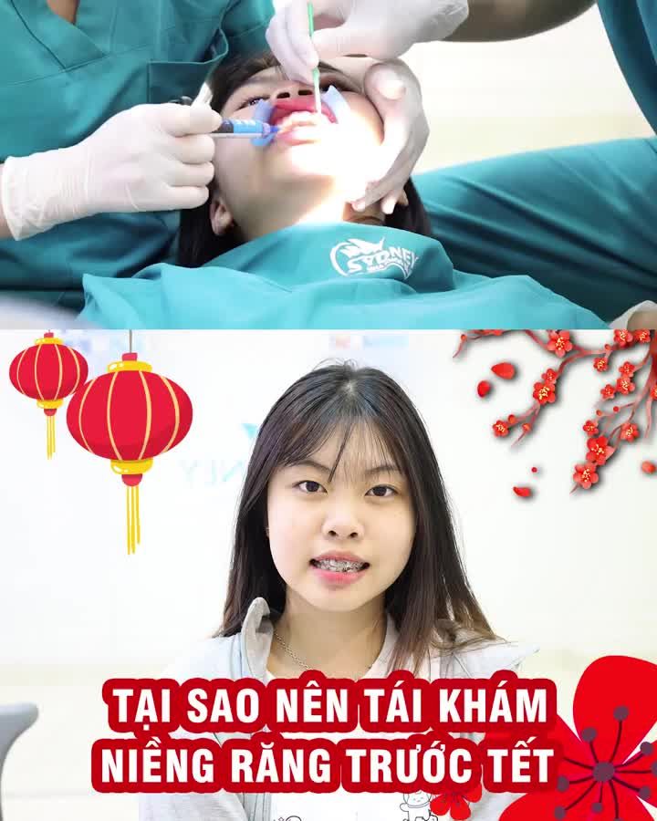 Tại sao nên tái khám hàm niềng trước tết ?