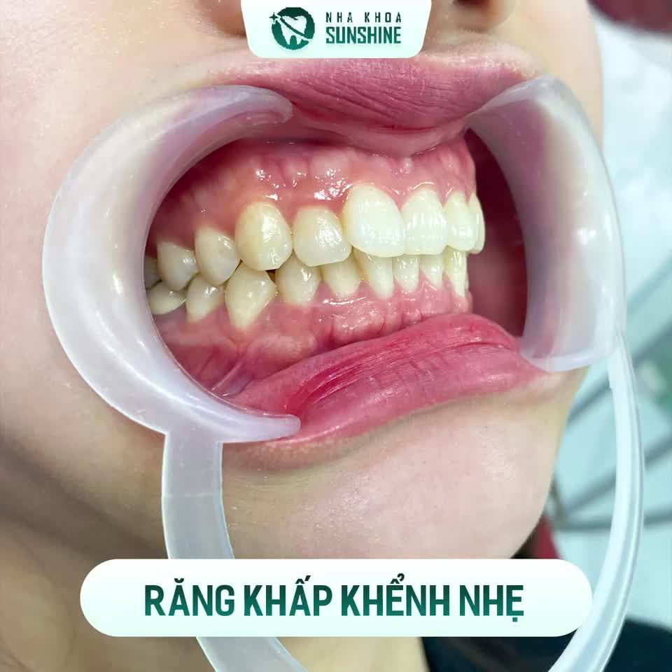 LÀM RĂNG CƯỜI XINH – RINH NHIỀU TÀI LỘC