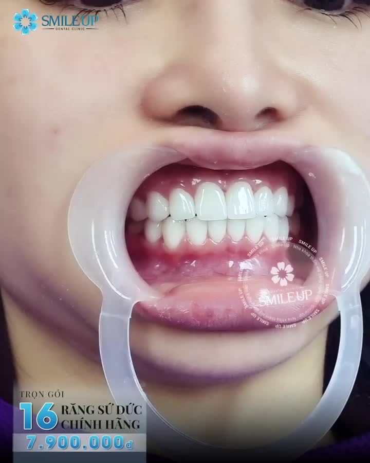 THAY ĐỔI NHỎ NHƯNG ĐEM LẠI KẾT QUẢ VÔ CÙNG LỚN