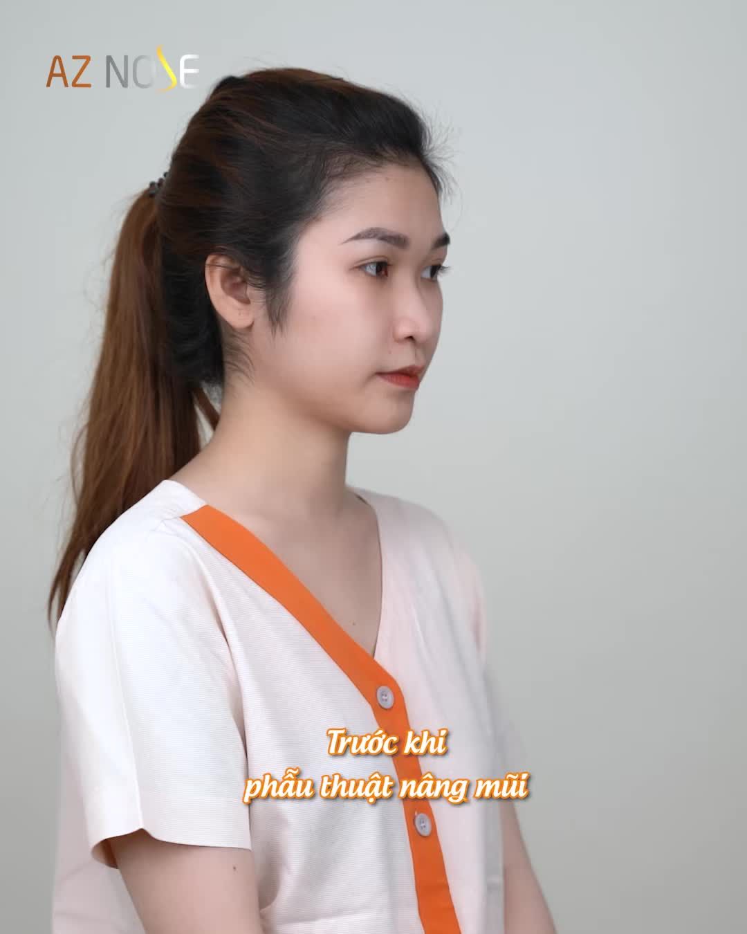 Không muốn bị ch.ê "mũi x.ấu", cô nàng 2K cùng mẹ từ Bạc Liêu lên Sài Gòn nâng mũi