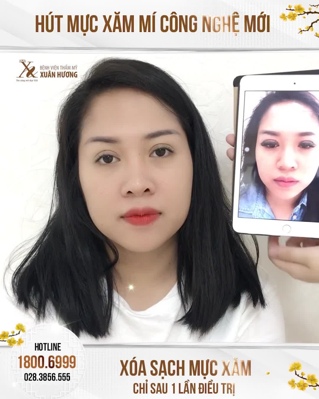 "HÚT MỰC XĂM MÍ Ở XUÂN HƯƠNG VỪA NHẸ NHÀNG MÀ LẠI HIỆU QUẢ NHANH"