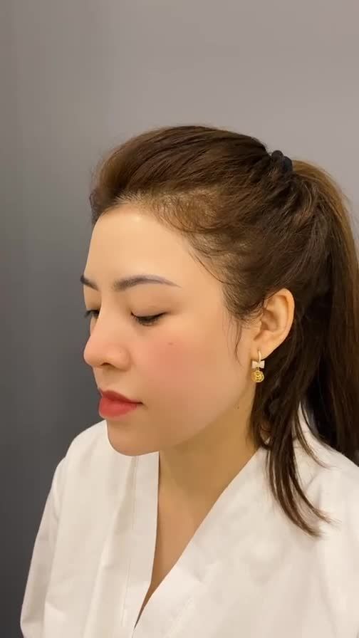 4 NĂM MŨI CÓ CÒN ĐẸP VÀ XINH XẮN NHƯ MỚI KHÔNG?
