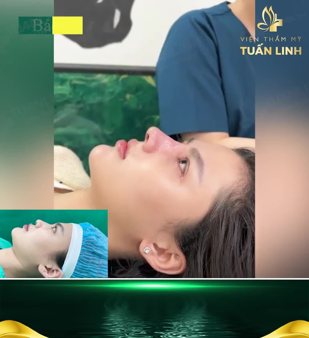 10 NGÀY MŨI ĐẸP KỊP