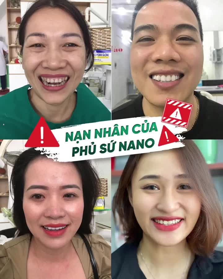 AI ĐANG LÀ NẠN NHÂN CỦA PHỦ SỨ NANO ĐỪNG BỎ QUA VIDEO NÀY!!!