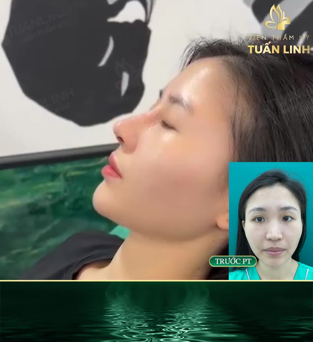 Tương truyền rằng: Nếu bạn và người yêu nắm tay nhau đi nâng mũi vào mùa Valentin này thì hai người sẽ bên nhau mãi mãi!!!