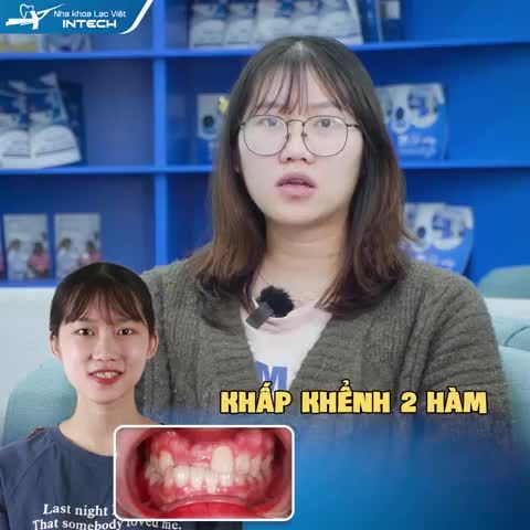 MÌNH HỐI HẬN VÌ… KHÔNG NIỀNG RĂNG SỚM HƠN