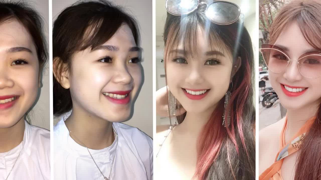 SỰ KẾT HỢP GIỮA NHA KHOA VÀ THẨM MỸ