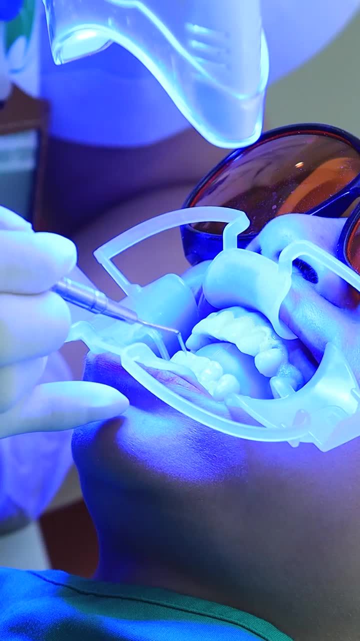 Các phương pháp tẩy trắng răng không gây đau.