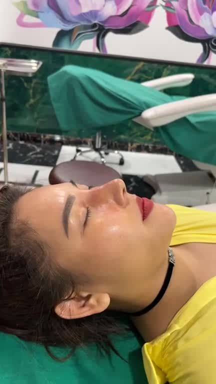Case mũi cấu trúc sụn mỹ 10 ngày