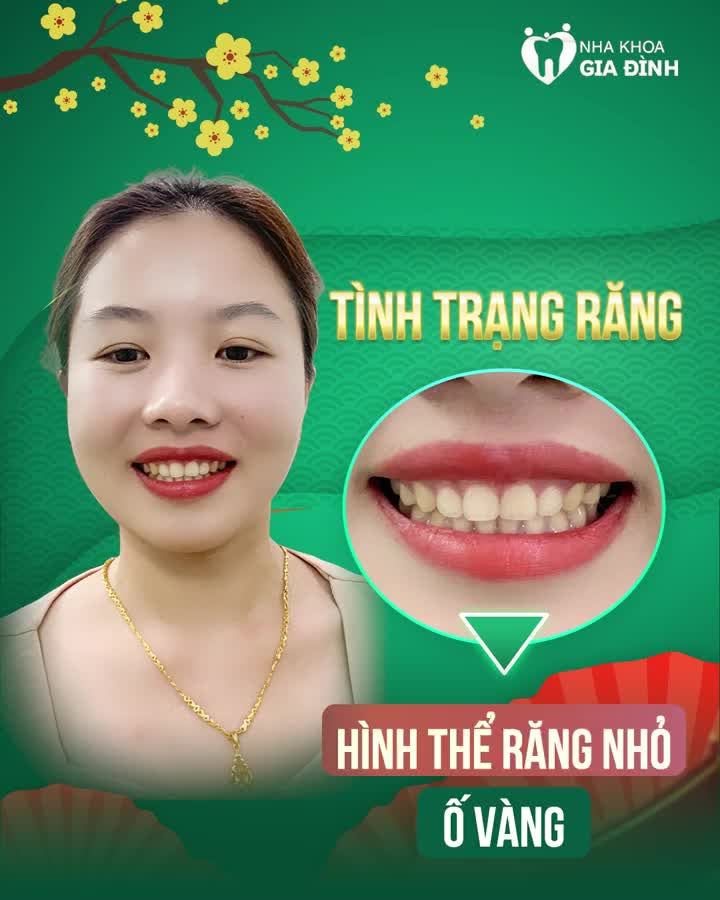 XUÂN SANG RỘN RÀNG - CƯỜI XINH RẠNG RỠ