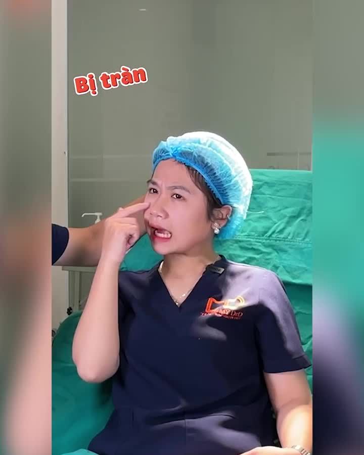 Tiêm Filler mũi có đơn giản không? Khi lựa chọn tiêm Filler mũi cần cân nhắc đến: