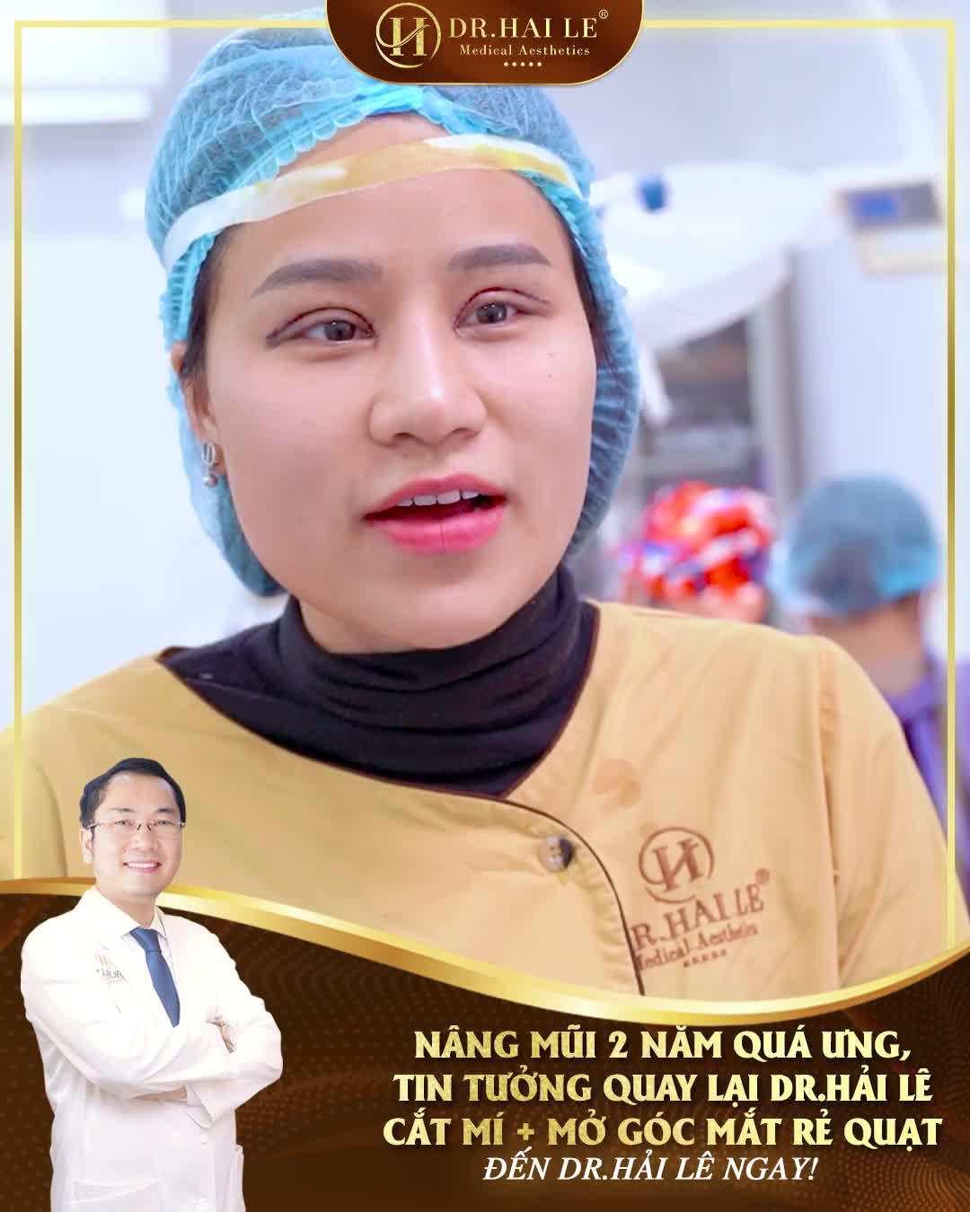 Quá ưng dáng mũi 2 năm, vị khách hàng quyết định quay lại Dr.Hải Lê thực hiện Combo Cắt mí + Mở góc mắt rẻ quạt để khuôn mặt như ý!