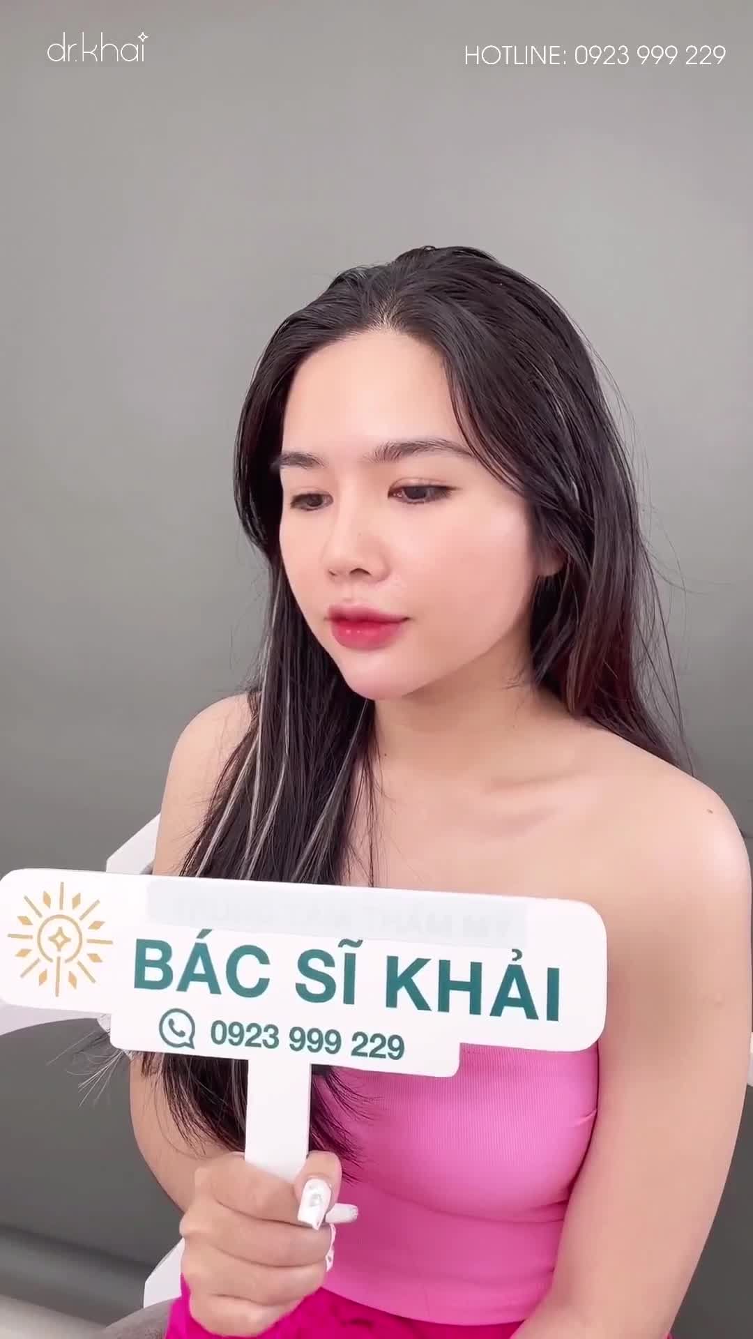 NÂNG MŨI CẤU TRÚC SỬA LẠI CHUẨN BỆNH VIỆN THẨM MỸ - MŨI TỈ LỆ VÀNG!