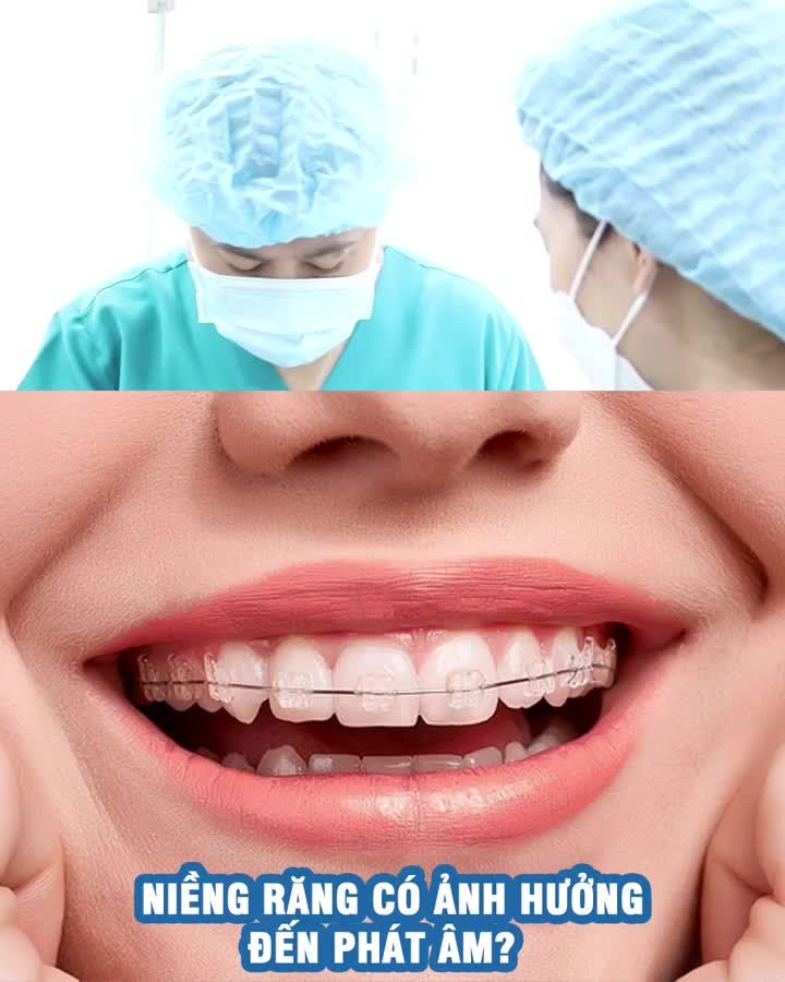 Niềng răng có bị hóp má không?