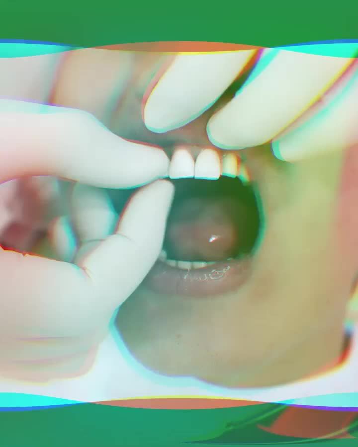 MẶT LẠNH ÍT CƯỜI LÀ CỦA NGÀY XƯA, BÂY GIỜ RĂNG ĐẸP LÂN KHOE MỖI NGÀY
