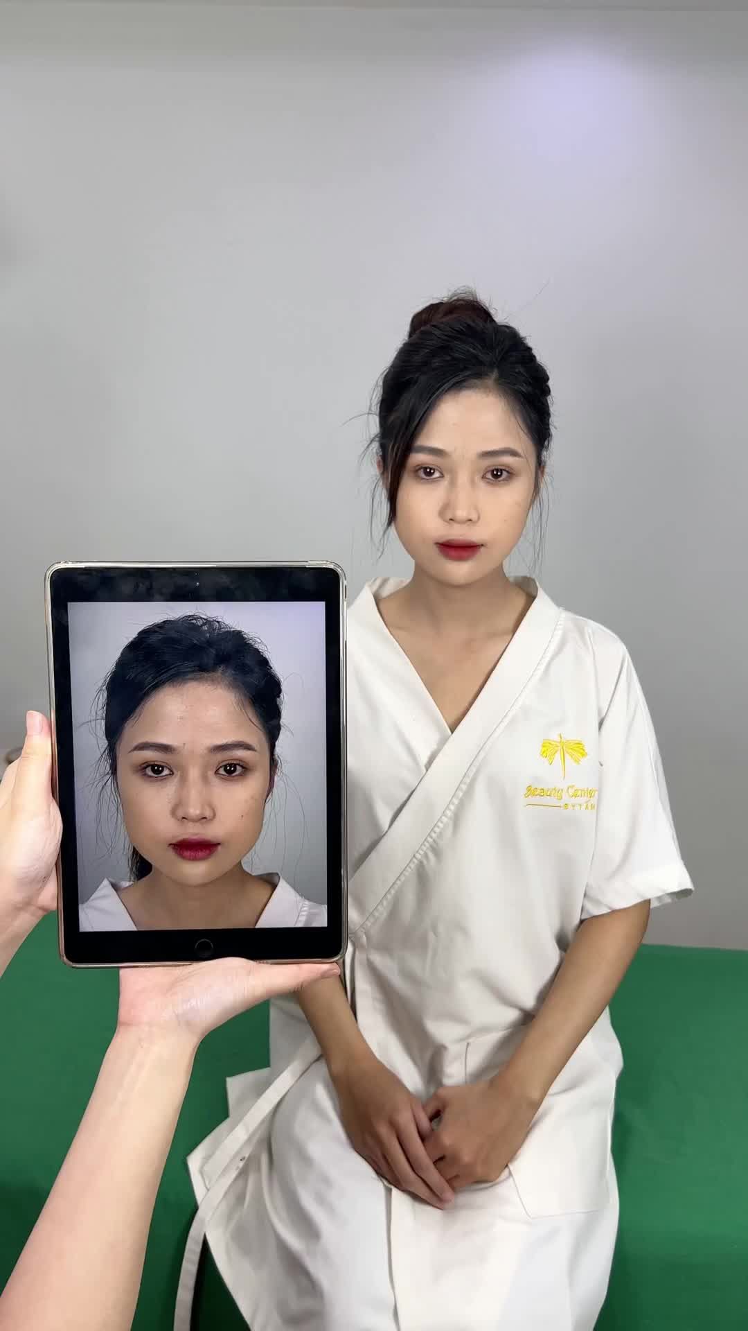 Ca Vline Perfect thon gọn hàm quay lại tái khám tại TMV Tấm