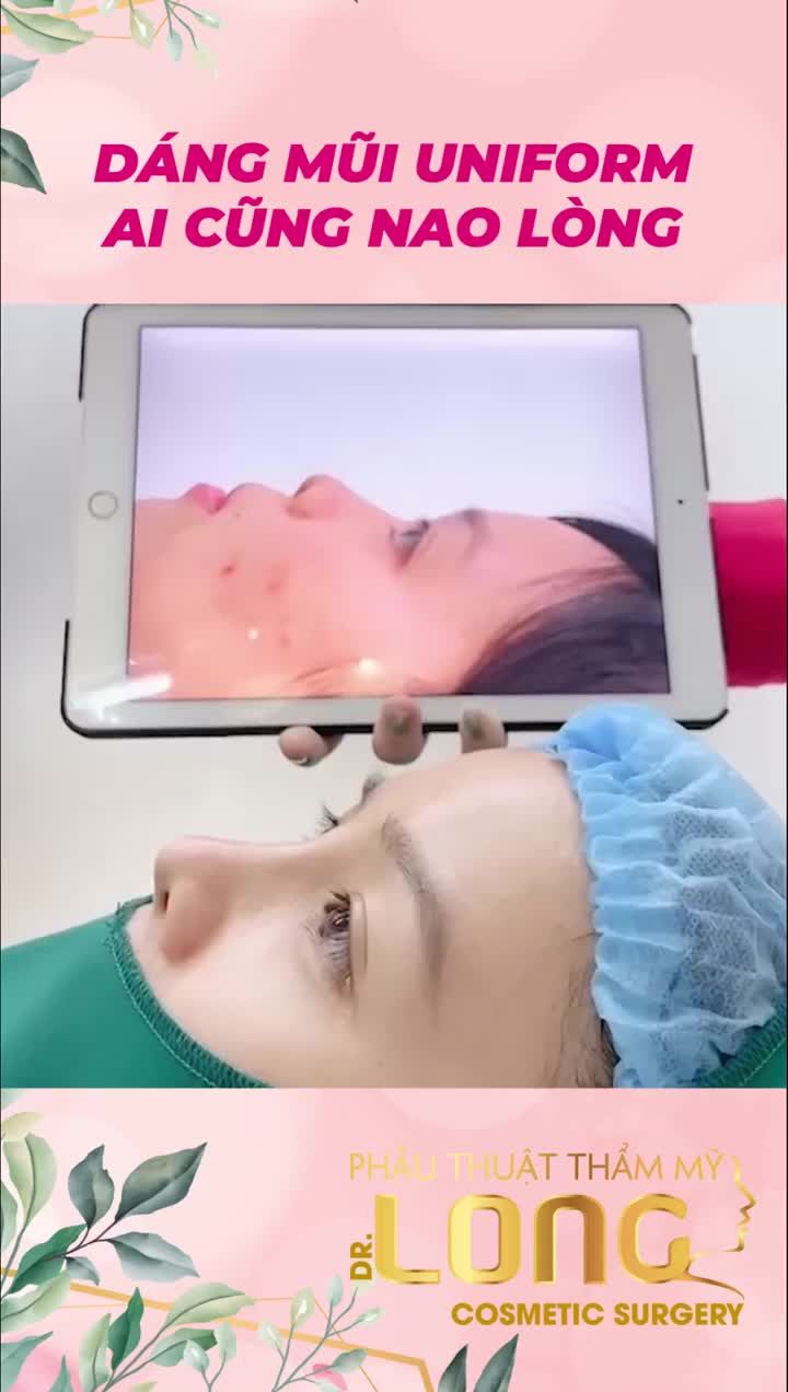 MŨI GÌ MÀ XINH XINH THẾ XIN THƯA RẰNG DÁNG MŨI TẠI PTTM Bác sĩ Long