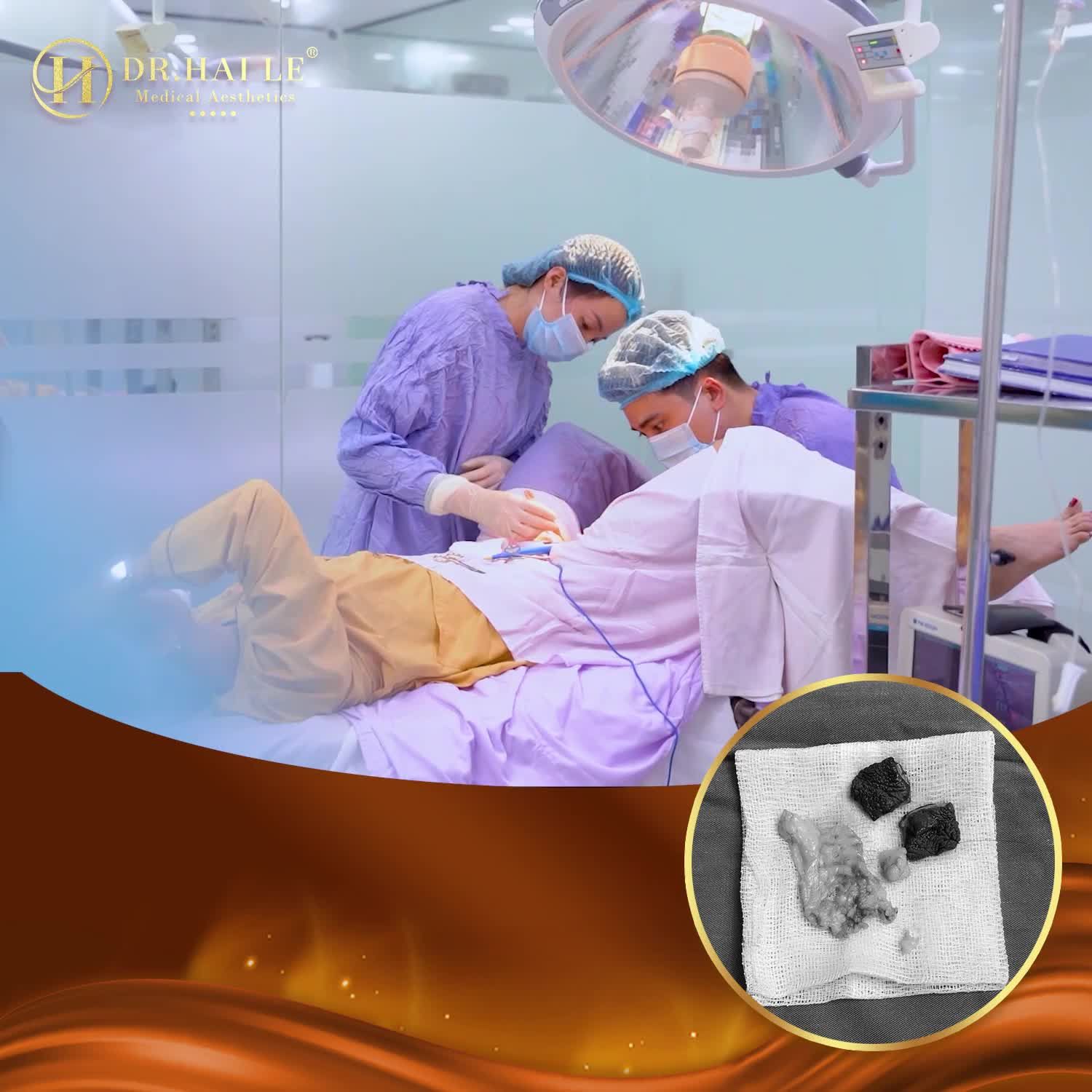Sinh thường 2,3 đứa con khiến C.ô B.é của chị em chùng nhão, chảy xệ...kém hấp dẫn