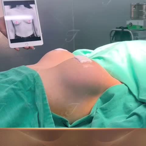 Khởi động tuần mới bằng một chiếc video xịn xò về kết quả sau 45 phút Bs Tươi thực hiện nâng cấp vòng 1 cho chị khách hàng.