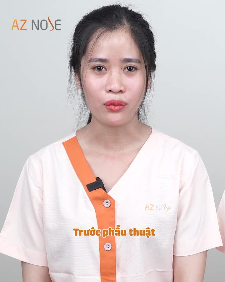 Nâng mũi cùng bạn thân... Là cùng nhau xinh đẹp hơn mỗi ngày