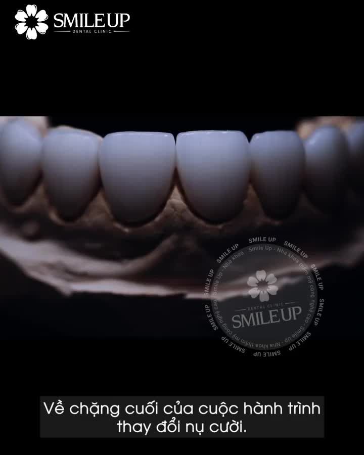 DẪN ĐẦU CÔNG NGHỆ THẨM MỸ BẢO TỒN RĂNG GỐC